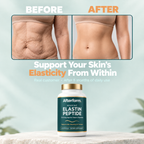 Marine Elastin Peptide